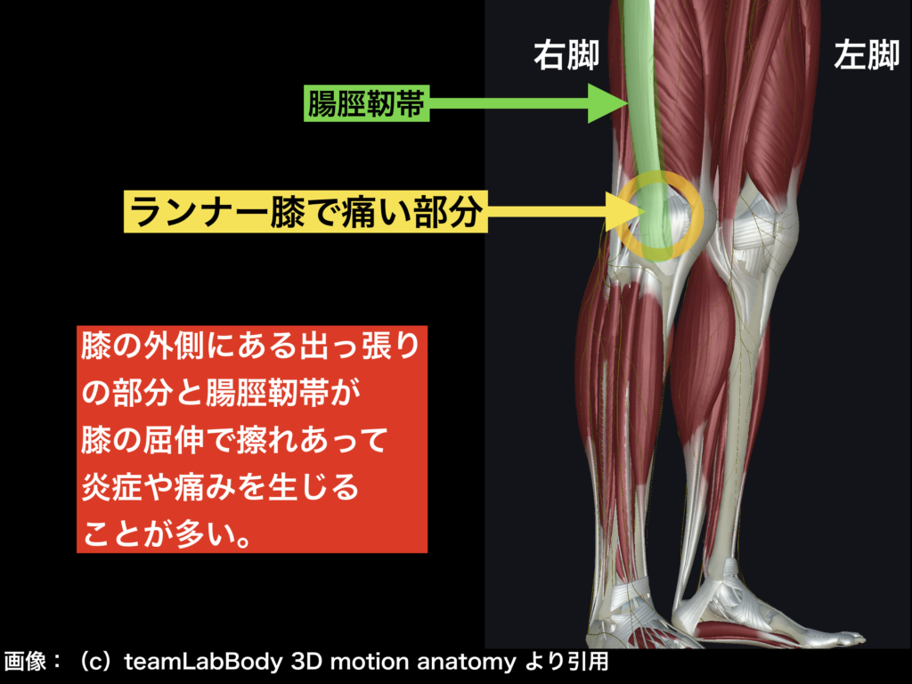 ランナー膝　筋膜リリース