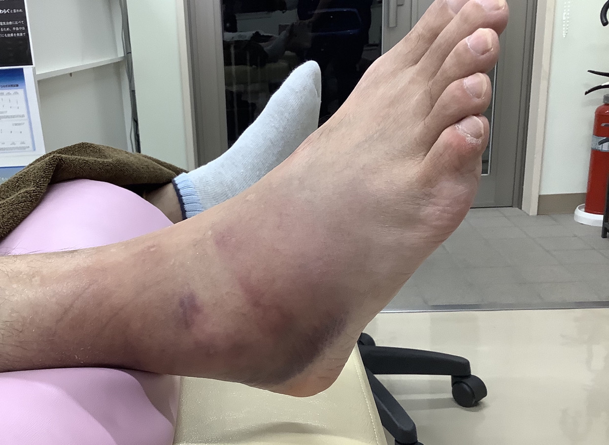 回復にはどのくらい時間がかかりますか?