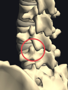 図１：腰椎椎弓側面