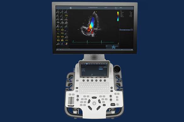 心臓エコー検査機